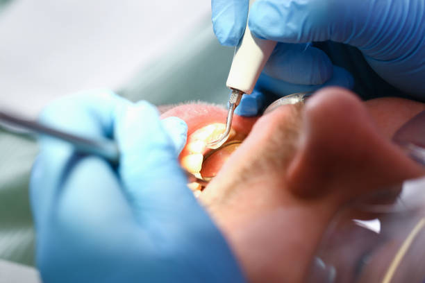 Best Pediatric Emergency Dentist in Blackwells Mills, NJ